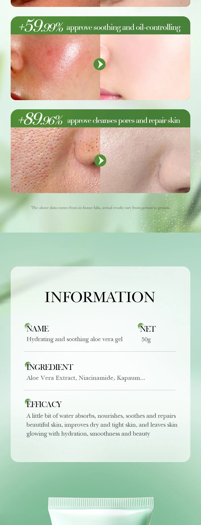 BIOAOUA Soothing Aloe Vera Gel For Face & Body Hydrating Moisturizing Repairing Sunburn Relief Acne Care For Sensitive Skin