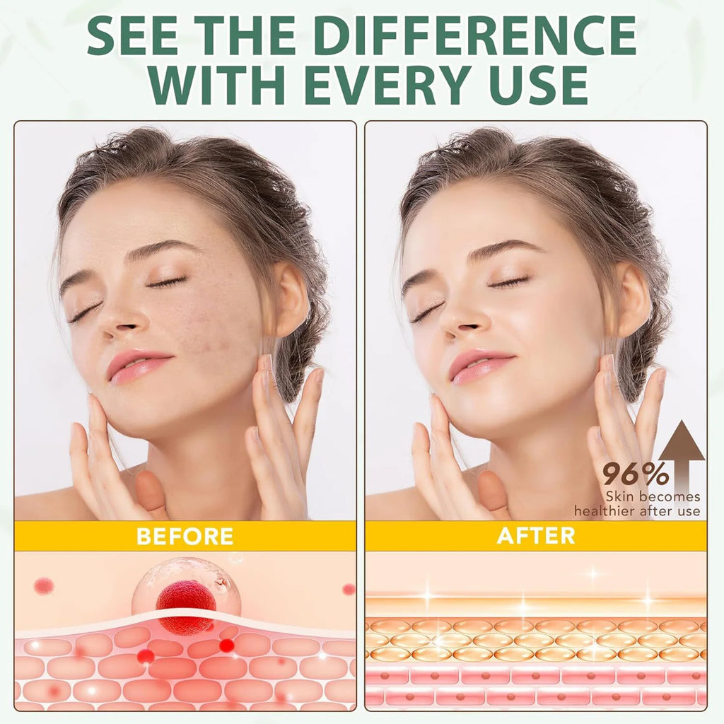 Tallow Face Cream Moisturizer Organic-Grass Fed Whipped Beef Tallow with Honey Beeswax Nourishing Moisturizing for Face Body