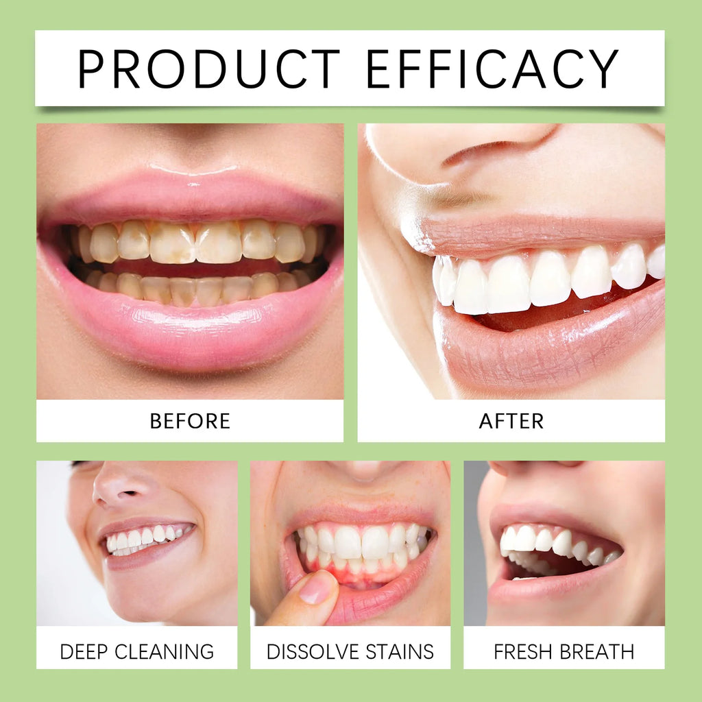 Aloe Vera Toothpaste For Gentle Teeth Cleaning - Remove Odor & Stains, Brighten Smile, Enamel Protection Formula