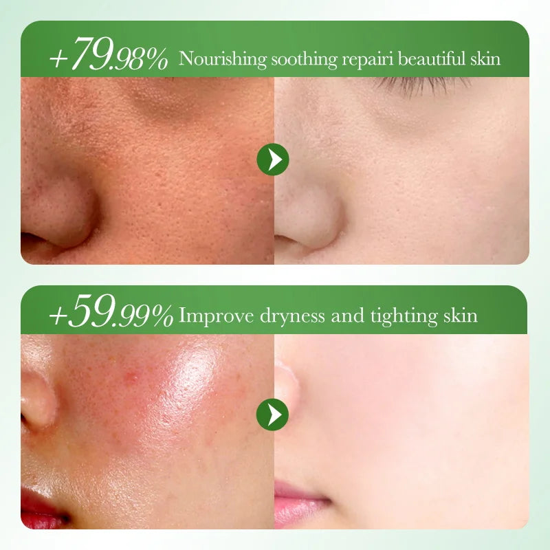 Aloe Vera Extract Gel For Face & Body, 99% Aloe Gel Essence Soothing Moisturizing Skin After Sun Care, For Scalp &Hair Hydration